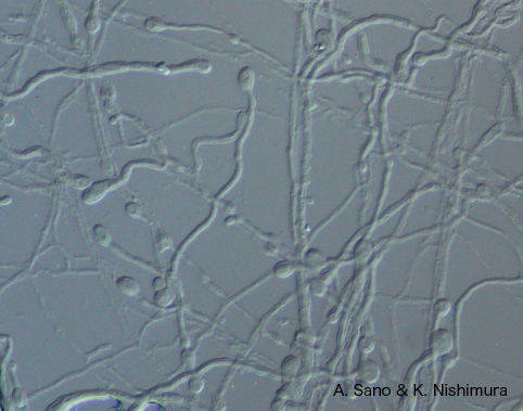 Blastomyces Dermatitidis
